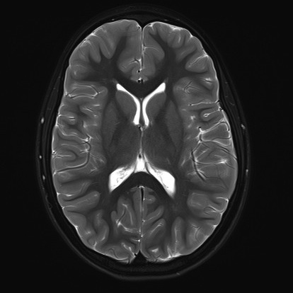 MRI - Magnetresonanz-<br>tomographie